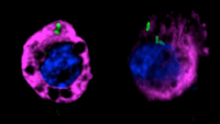 two cells infected with bacteria